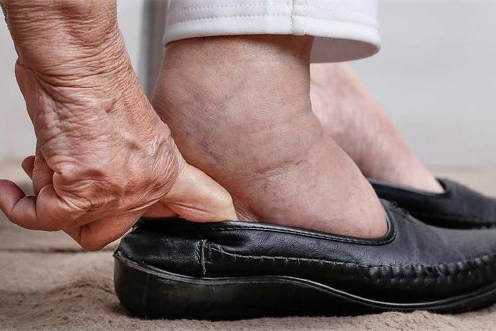 Когда отекают ноги у пожилых людей